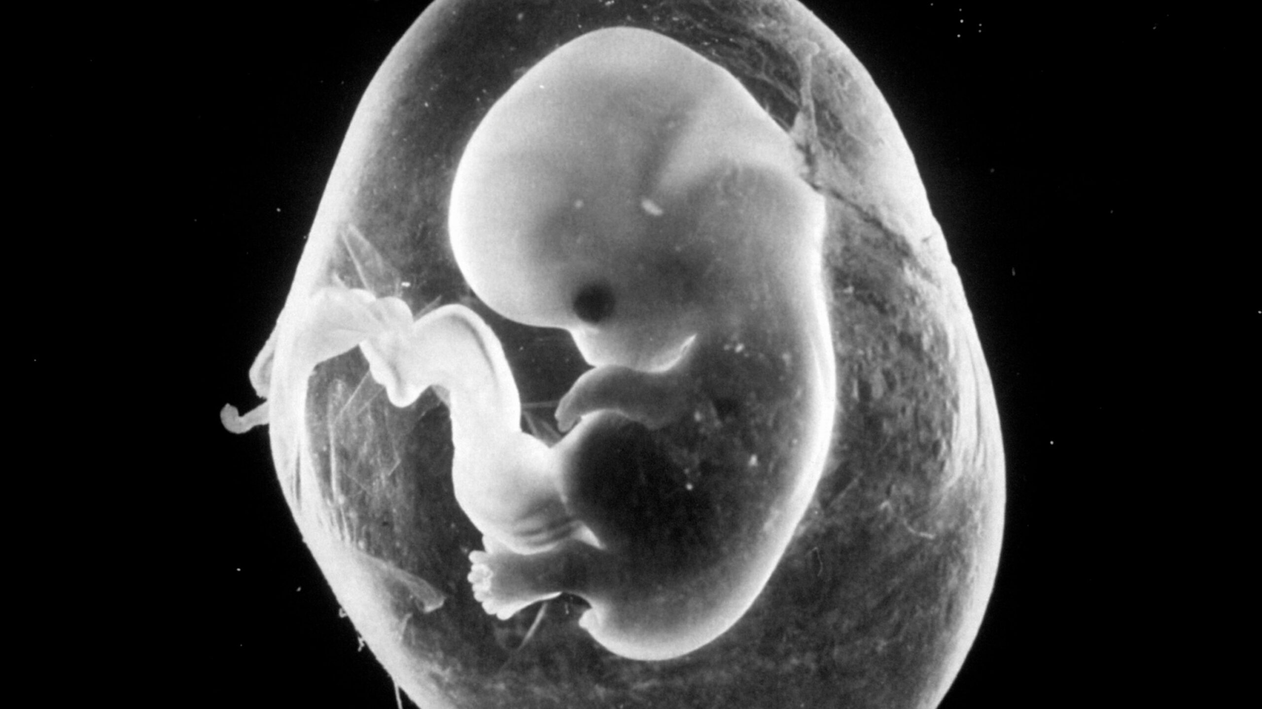 08PREGNANCY videoSixteenByNine3000 scaled