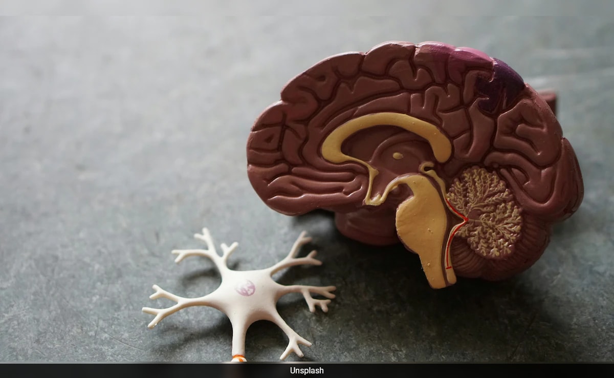 enn01sag brain cells